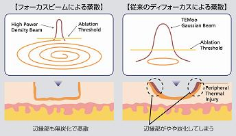 蒸散の説明図